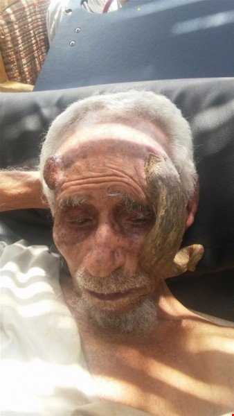 بریدن شاخ پیرمرد یمنی که  ۱۴۰ ساله سن داشت موجب مرگش شد