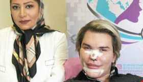 جراحی زیبایی ، بسیاری از افراد مشهور را به ایران میاورد